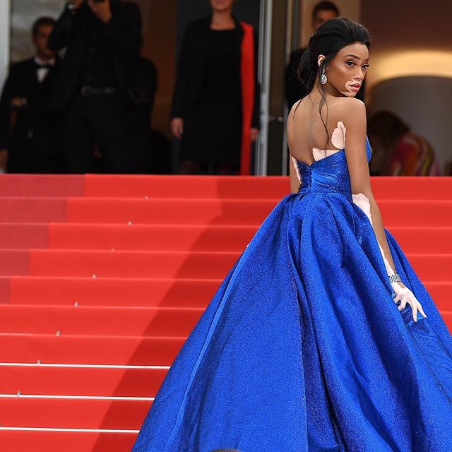 Cannes Film Festival,Cannes Film Festival 2017,Cannes,Cannes 2017,Winnie Harlow,Winnie Harlow at Cannes,Winnie Harlow at Cannes Film Festival,Winnie Harlow pics,Winnie Harlow images,Winnie Harlow stills,Winnie Harlow pictures,Winnie Harlow photos