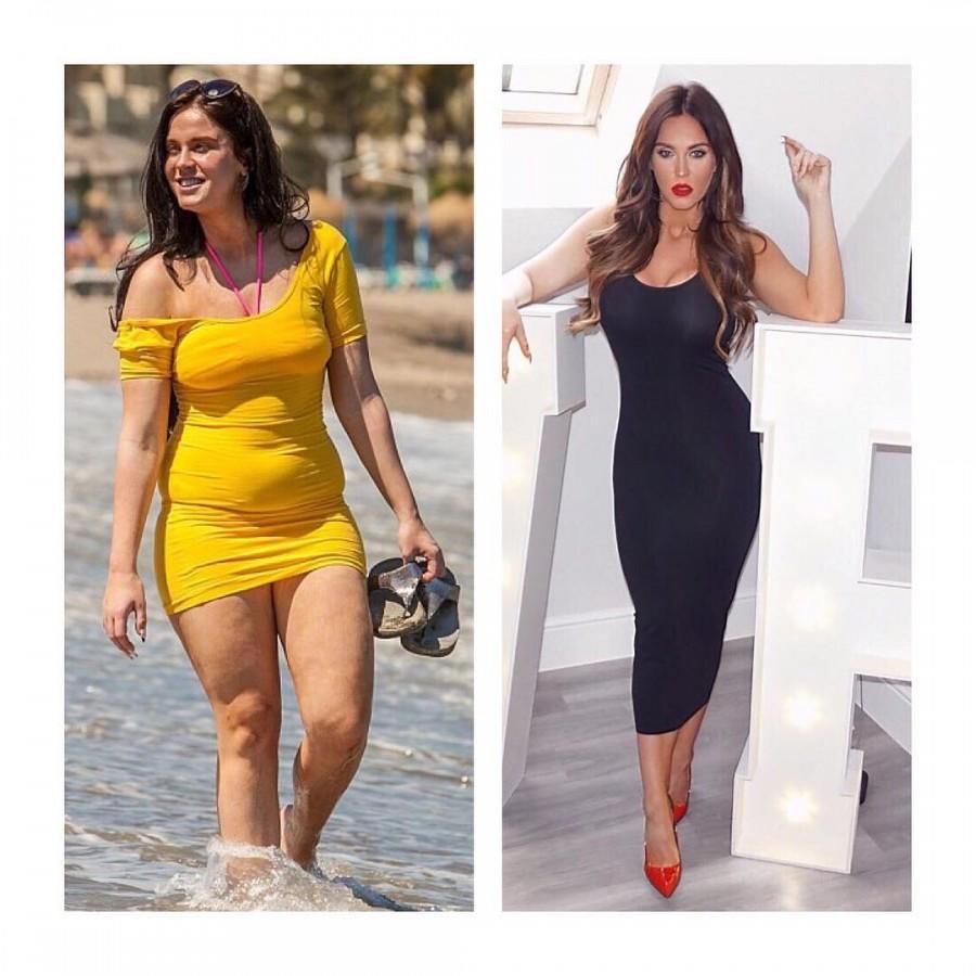 Star-turned-TV presenter Vicky Pattison continues to show off weight loss. Vicky Pattison,Vicky Pattison weight loss,Vicky Pattison Transformation,Vicky Pattison Transformation pics,Vicky Pattison Transformation images,Vicky Pattison Transformation stills,Vicky Pattison Transformation pictures