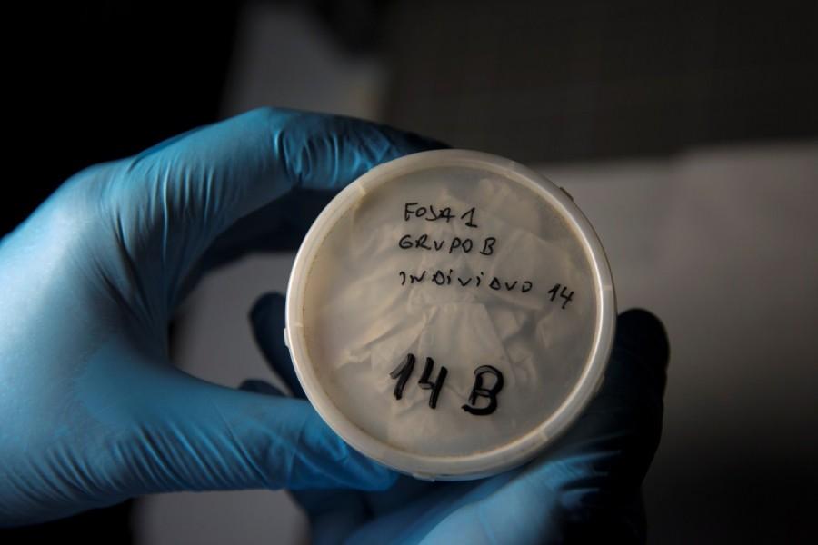 Archaeologists excavating a Spanish Civil War-era mass grave have found the naturally preserved brains of 45 people, eight decades after they were shot and buried on a hillside. Preserved brains,Spanish grave,Spanish Civil War