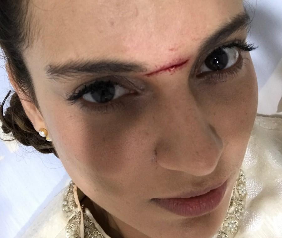 Kangana was shooting here on Wednesday with co-star Nihar Pandya. The "Queen" star was rushed to the Apollo Hospital amidst pain and blood loss. She got 15 stitches on the forehead and has been advised rest for four days. "I am a bit embarrassed to be thrilled to have a battle scar on my face. Also, people from my team have been telling me that it's like that ‘Peshwa teeka' that ‘Manikarnika' wore," Kangana said in a statement. Kangana Ranaut,Kangana Ranaut injured,Manikarnika,Kangana Ranaut Manikarnika The Queen Of Jhansi,Manikarnika on the sets