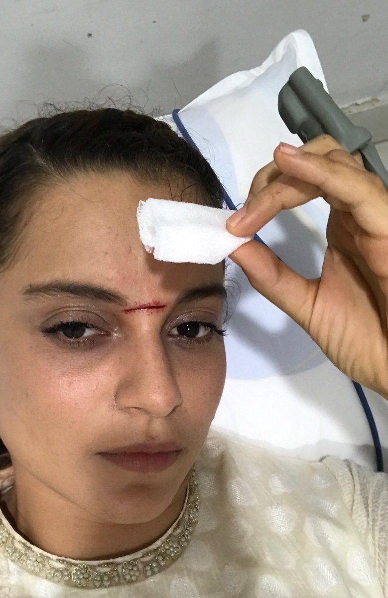 "It's a bit dramatic, but I am excited that my face was covered in blood and I got a genuine and authentic glimpse of the Queen's life," she added. Kangana has been training hard in sword fighting under Hollywood stunt director Nick Powell. She is also taking horse riding lessons. Directed by Krish, "Manikarnika - The Queen of Jhansi" features Kangana as Rani Laxmibai. Kangana Ranaut,Kangana Ranaut injured,Manikarnika,Kangana Ranaut Manikarnika The Queen Of Jhansi,Manikarnika on the sets