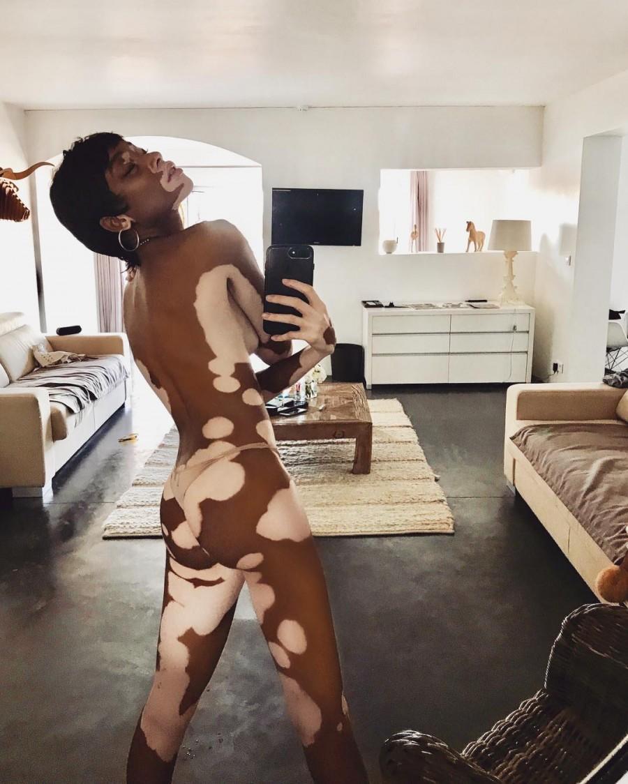 Winnie Harlow strips skimpy nude-coloured thong in sizzling snap. Winnie Harlow,Winnie Harlow nude,Winnie Harlow strips skimpy nude-coloured,Winnie Harlow sizzling snap,Winnie Harlow sizzling pics,Winnie Harlow sizzling images,Winnie Harlow sizzling stills,Winnie Harlow sizzling pictures
