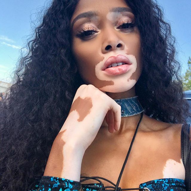 Winnie Harlow latest images. Winnie Harlow,Winnie Harlow nude,Winnie Harlow strips skimpy nude-coloured,Winnie Harlow sizzling snap,Winnie Harlow sizzling pics,Winnie Harlow sizzling images,Winnie Harlow sizzling stills,Winnie Harlow sizzling pictures