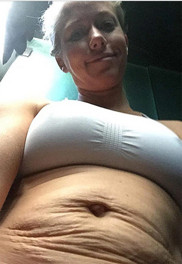 Kendra Wilkinson flaunts her stretch marks. Padma Lakshmi,Ashley Graham,Kendra Wilkinson,Chrissy Teigen,Jessie James Decker,Leann Rimes,celebs stretch marks,stretch marks,Padma Lakshmi stretch marks