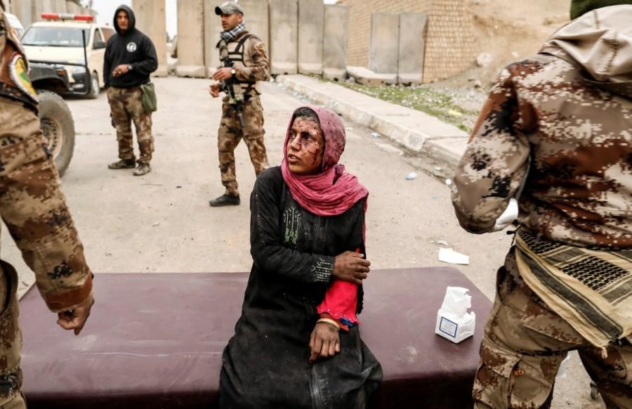 A woman injured in a mortar attack is treated by medics in a field clinic as Iraqi forces battle with Islamic State militants, in western Mosul, Iraq March 2, 2017. Zohra Bensemra,Reuters photojournalist,Guardian newspaper,Islamic State,Rohingya refugee crisis