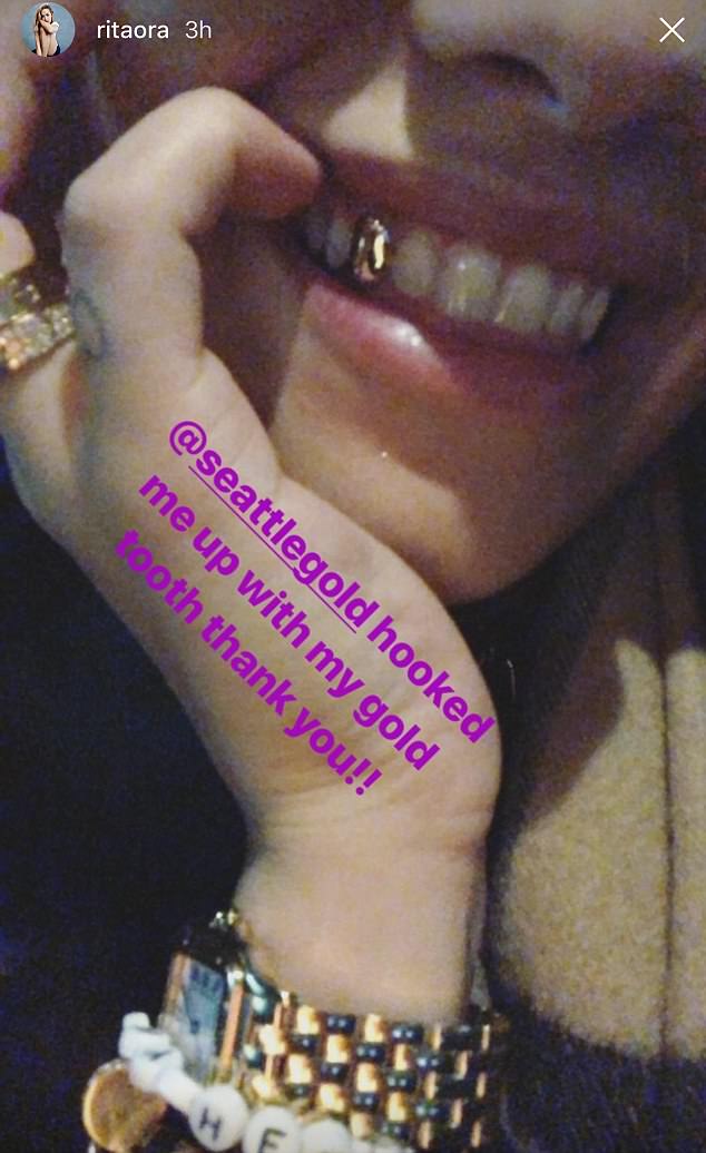 One fan also questioned whether the tooth is permanent or not. "I hope this isn't permanent?". Besides the gold tooth, Ora was also seen wearing sparkly gold eye shadow and hoop earrings in the video. Rita Ora,Singer Rita Ora,Rita Ora gold tooth,Rita Ora gold tooth pics,Rita Ora gold tooth images,Rita Ora gold tooth stills,Rita Ora gold tooth pictures,Rita Ora gold tooth photos,Rita Ora gold tooth picture