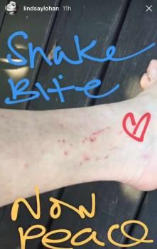 Actress Lindsay Lohan says she was bitten by a snake while she was on a vacation in Thailand. The 31-year-old actress took to Instagram Story on Thursday to share an image of her snake bite, reports eonline.com. In the first video post, Lohan showed her social media followers the view from her location in here. 