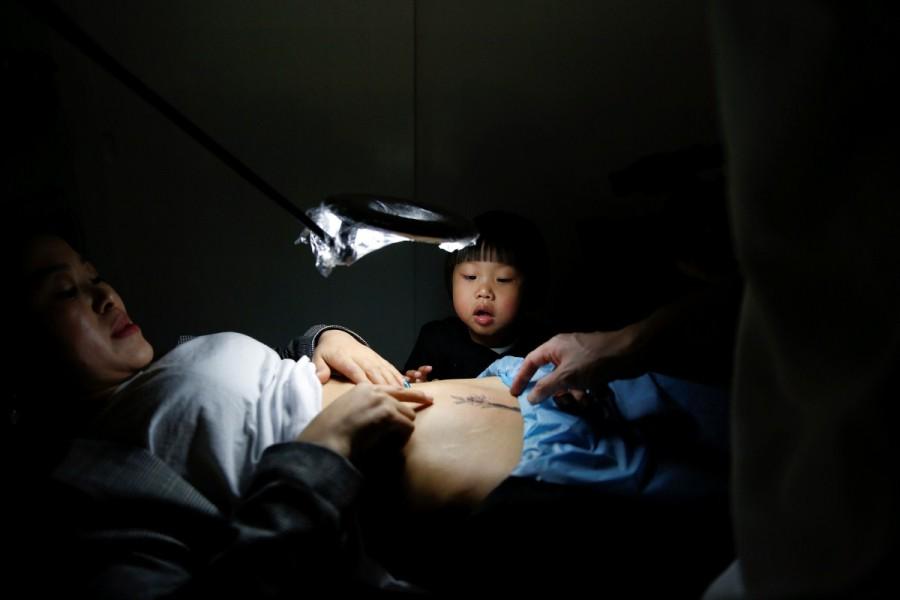 Grace Yuan's 3-year-old daughter Rebecca, looks at the caesarean delivery (C-section) scar on her mother's belly, which is being worked on by a tattoo artist, at Samurai Tattoo in Shanghai, China, April 26, 2017. Yuan's daughter thinks the scar is ugly, making Yuan want to cover it up. As a dance teacher, she feels awkward when the scar is exposed as she wears dancing costumes. "Now I feel more confident after getting this tattoo. I can dance freely on the stage without worries or awkwardness," said Yuan. C-section,C-Section Tattoos,C-Sectoin,Caesarean,caesarean delivery,Chinese Mothers,tattoos,Weird Tattoos,Pregnant Tattoos,Tattoos When Pregnant