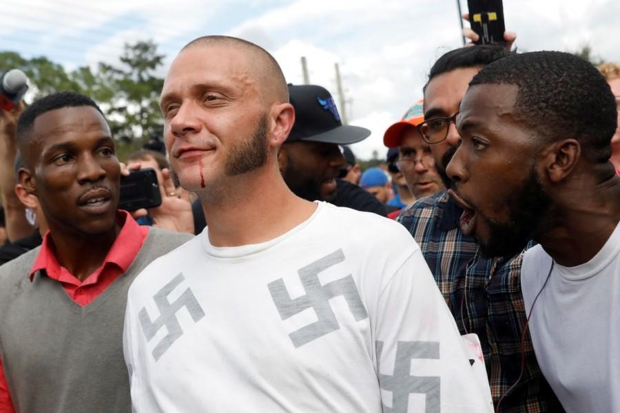 A man walks with a bloody lip as demonstrators yell at him outside the location where Richard Spencer, an avowed white nationalist and spokesperson for the so-called alt-right movement, delivered a speech on the campus of the University of Florida in Gainesville, Florida. Supporters,Trump,Donald Trump,US President Donald Trump,polarized politics