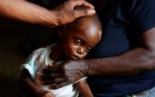 Mbuji Mayi, Congo, the Democratic Republic of theKaba Bitika Marie, 19 months, an internally displaced and severely acute malnourished child receives medical attention at the Presbyterian hospital in Dibindi zone of Mbuji Mayi in Kasai Oriental Province in the Democratic Republic of Congo.