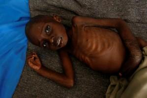 Hunger brings death after Congo violence,Congo violence,Mwene Ditu,Hunger brings death