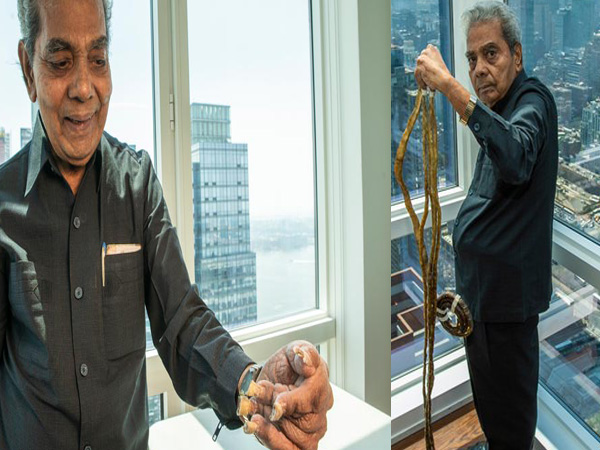 Shridhar Chillal,Shridhar Chillal longest nails,longest nails,longest nails cuts them,Guinness World Record,Guinness World Record for longest nails